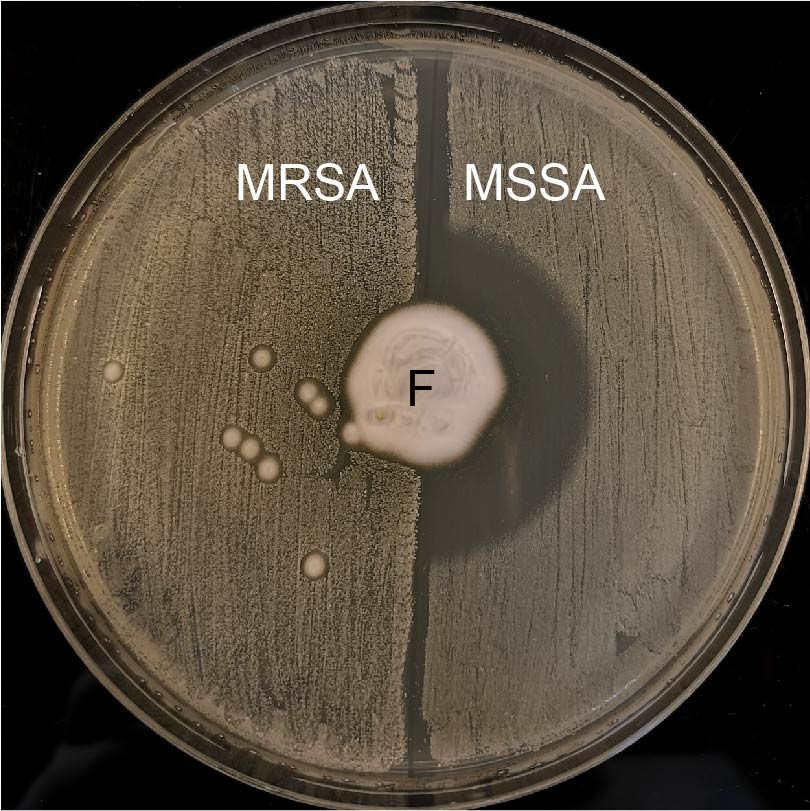 Billede af MRSA 01